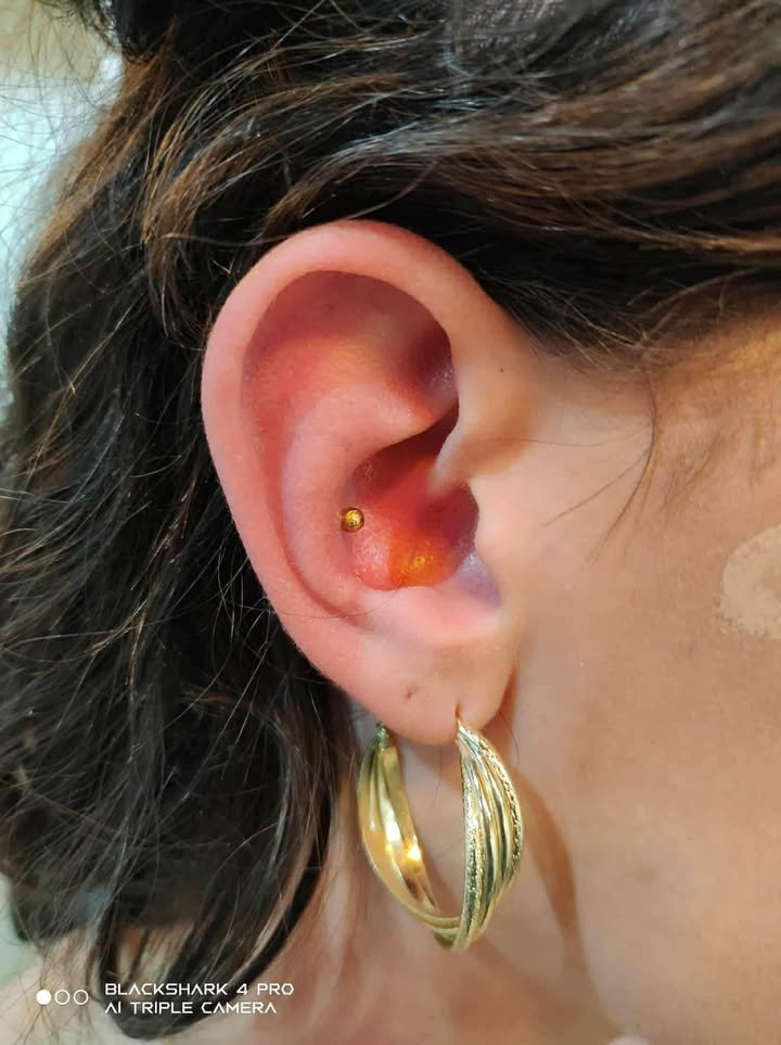 ผลงานสัก